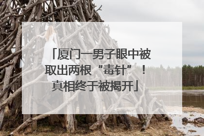厦门一男子眼中被取出两根“毒针”！真相终于被揭开